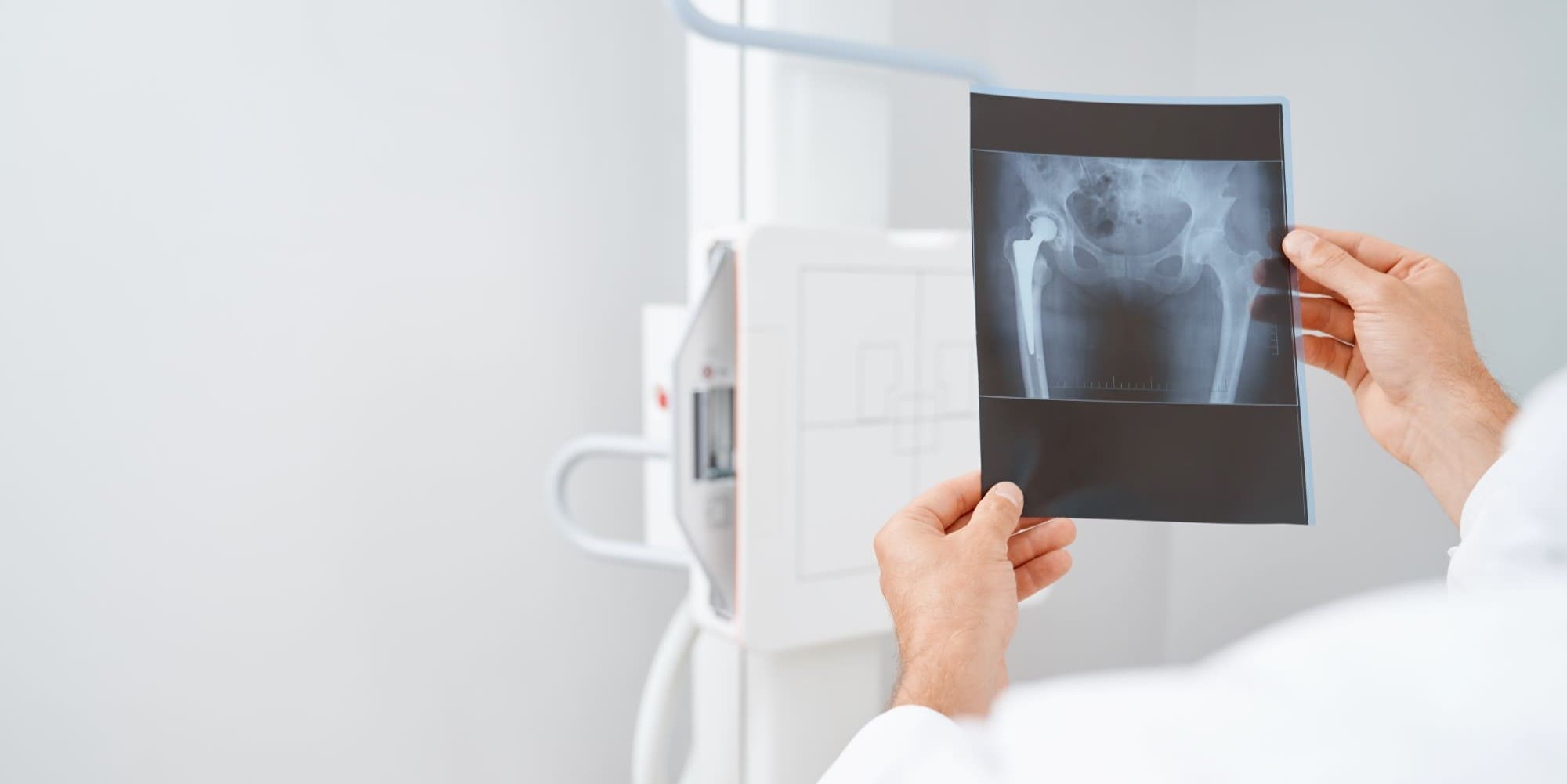 Рентген таза, тазобедренных суставов