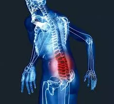 МРТ пояснично крестцового отдела позвоночника